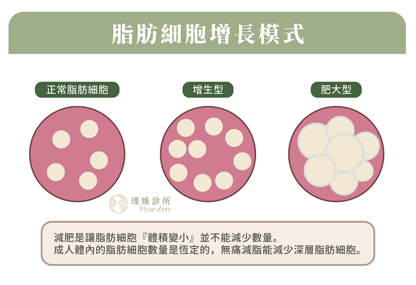 無痛減脂減少深層脂肪細胞，成人體內的脂肪細胞數量是恆定的，肥胖讓脂肪細胞體積增加，透過飲食控制、運動等方式能讓脂肪細胞體積縮小，但脂肪細胞數量不會改變。若減重後再次恢復不良飲食習慣，便容易造成復胖，甚至讓脂肪細胞變得更巨大。