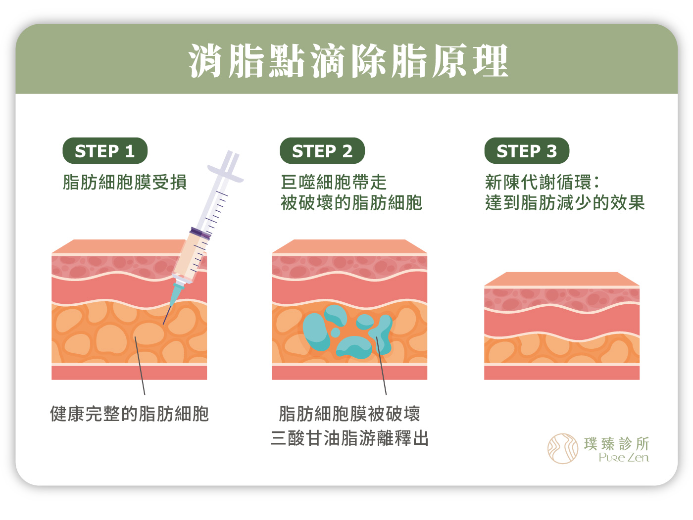 消脂點滴除脂原理_代謝中性脂肪和膽固醇_脂肪細胞乳糜化排出過程