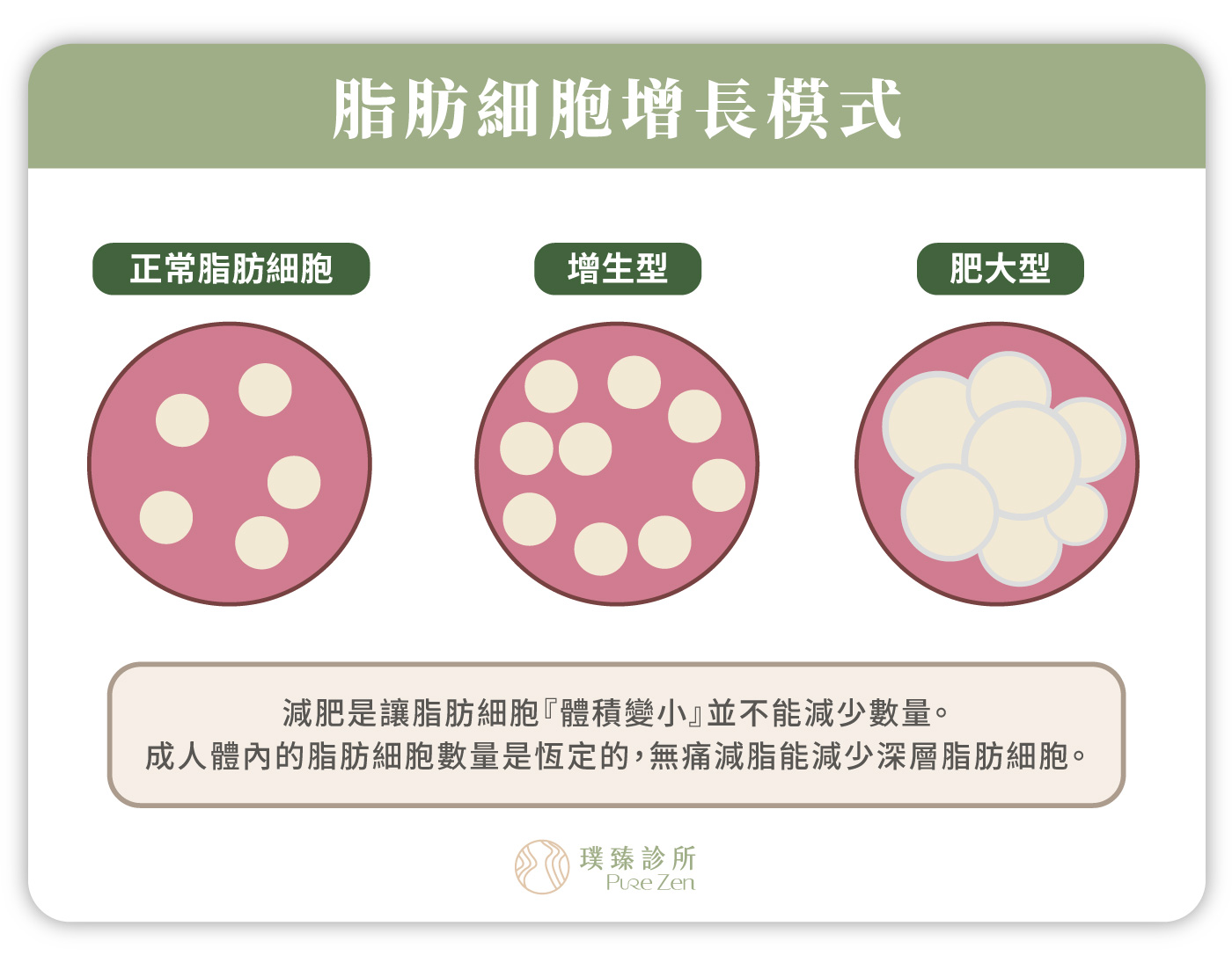 脂肪細胞增長模式