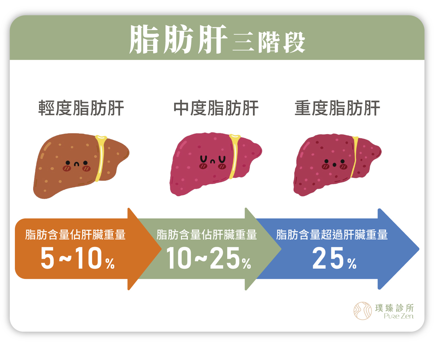 脂肪肝3階段_脂肪肝是未來的糖尿病患者