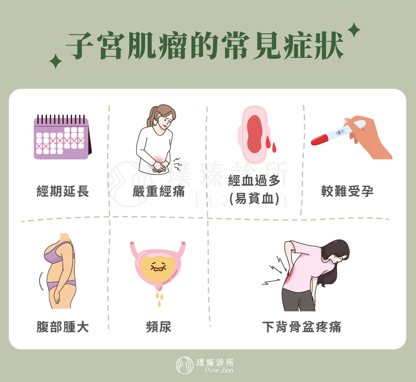 子宮肌瘤的常見症狀,大部分的子宮肌瘤沒有症狀,僅有三到五成的患者會出現:經痛、經血過多、經期延長、月經失調(較難受孕)、出血、貧血、性交疼痛、頭暈或疲勞。若子宮肌瘤持續生長造成壓迫,會導致腹部隆起、腹痛,可能產生頻尿、腸阻塞、子宮肌瘤組織壞死、慢性骨盆腔疼痛、腎臟水腫、輸尿管水腫、下肢血管栓塞等症狀。 子宮肌瘤的常見症狀