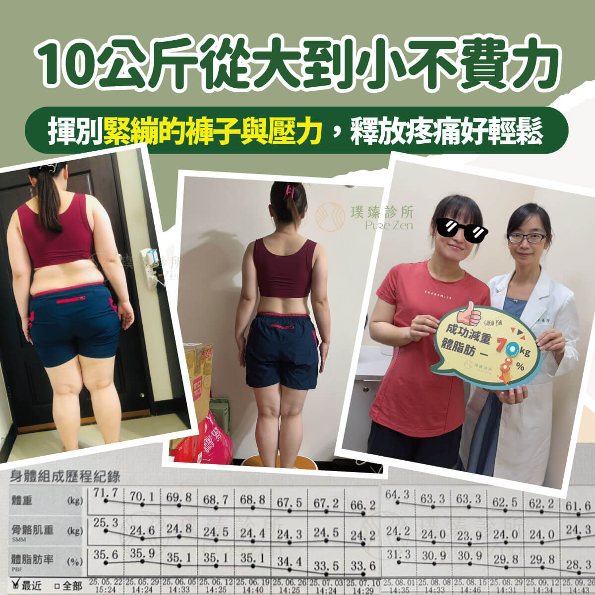 減重門診減重案例分享,猛健樂抑制食慾,代謝點滴改善身體疼痛問題,功能醫學減重協助減脂,成功減重10公斤 案例蛻變_小芬