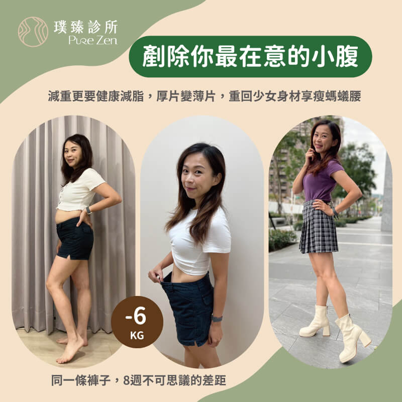 代謝內燃減重門診-減重案例分享-成功減重6公斤 代謝內燃減重門診-減重案例分享-成功減重6公斤