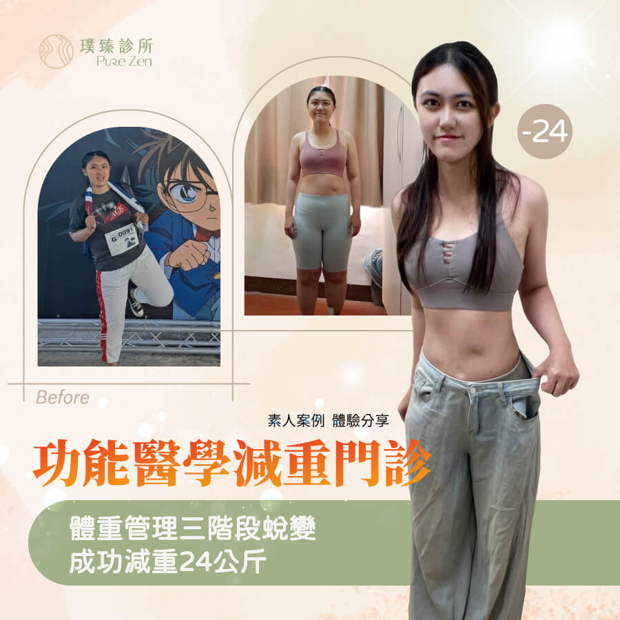減重案例分享,壓力肥胖無法控制食慾,功能醫學減重門診協助成功減肥24公斤 減重案例分享壓力肥胖無法控制食慾成功減肥24公斤_功能醫學減重m