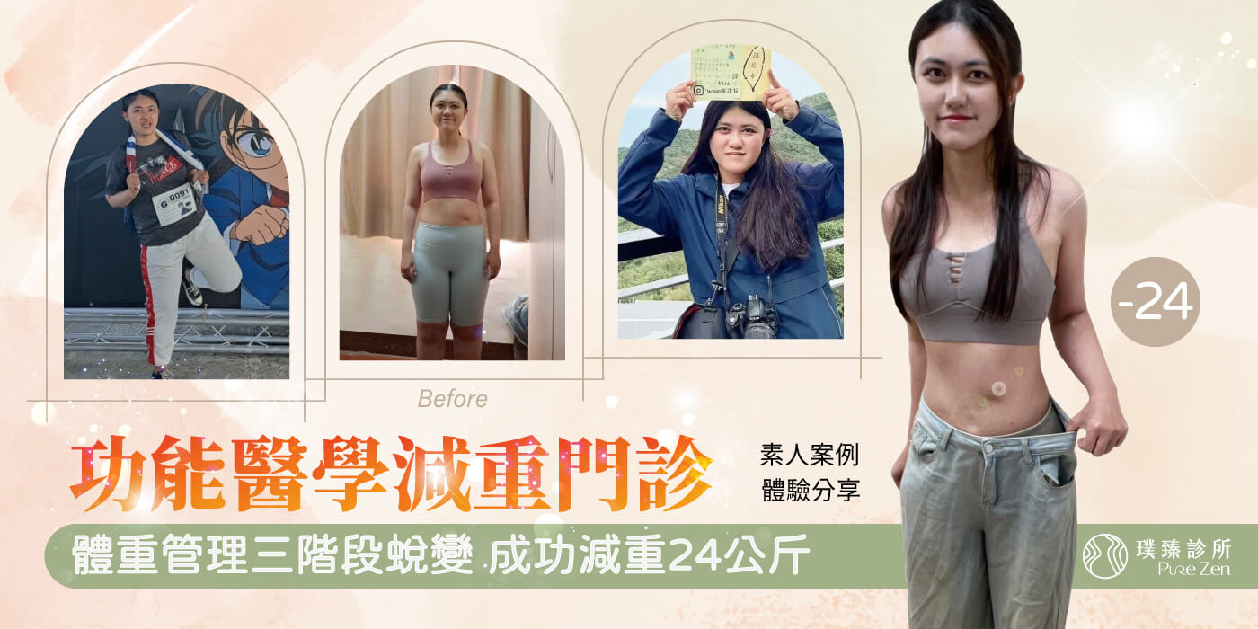 減重案例分享,壓力肥胖無法控制食慾,功能醫學減重門診協助成功減肥24公斤 減重案例分享壓力肥胖無法控制食慾成功減肥24公斤pc_功能醫學減重