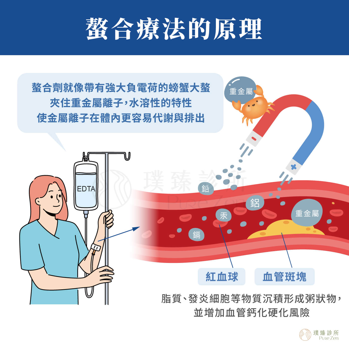 螯合療法的作用原理_螯合劑與重金屬產生螯合作用