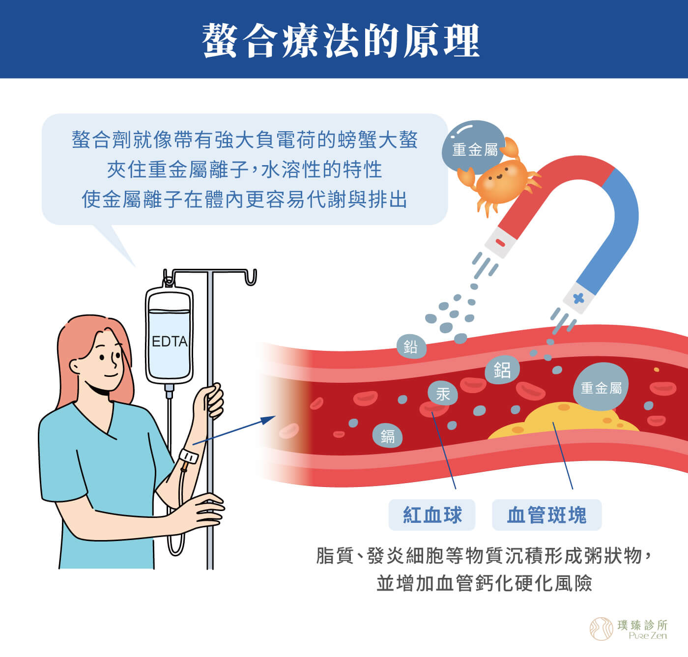 螯合療法的作用原理_螯合劑與重金屬產生螯合作用
