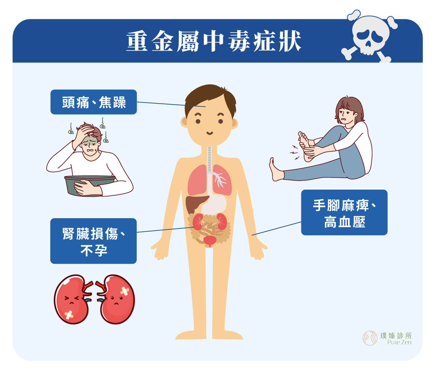 螯合點滴的適用對象,慢性的重金屬汙染,可能會產生頭痛、貧血、焦躁、顫抖、腹痛、厭食、便秘、手腳麻痺、注意力喪失、記憶力衰退等症狀,也會導致高血壓、心血管疾病、腎臟損傷、不孕等問題。 螯合點滴的適用對象_重金屬中毒症狀