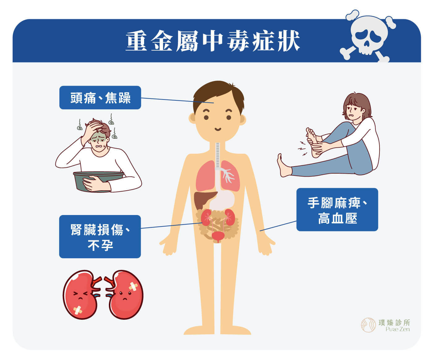 螯合點滴的適用對象_重金屬中毒症狀