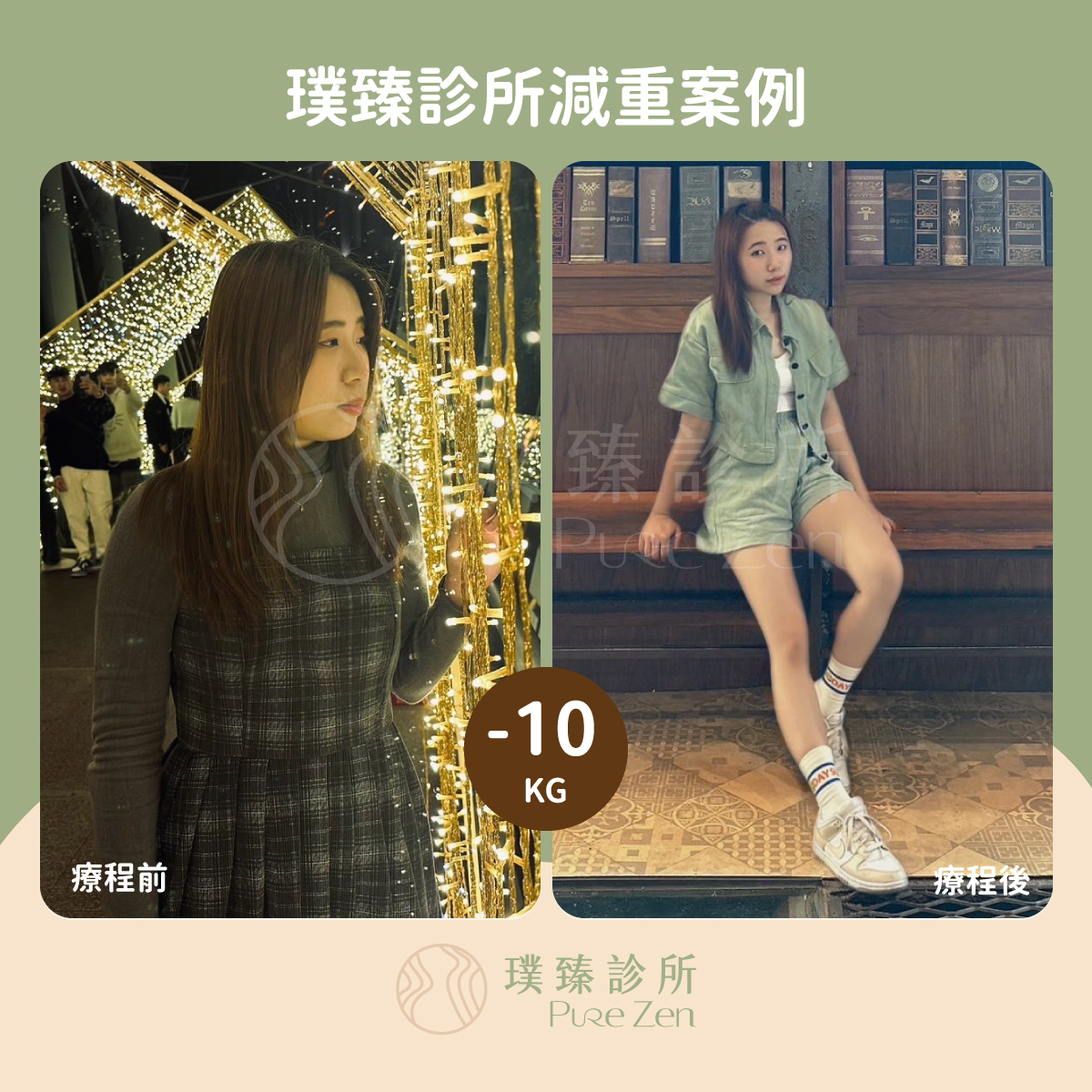 胃鏡減重案例-成功減重10公斤-多囊性卵巢減重個案 璞臻診所減重案例_06