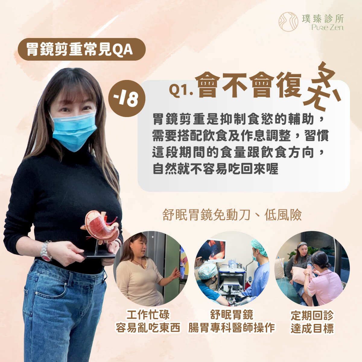 胃鏡減重常見QA-會不會復胖:胃鏡減重是抑制食慾的輔助,需要搭配飲食及作息調整,習慣這段期間的食量跟飲食方向,自然就不容易吃回來喔。 胃鏡減重常見QA-會不會復胖:胃鏡減重是抑制食慾的輔助,需要搭配飲食及作息調整,習慣這段期間的食量跟飲食方向,自然就不容易吃回來喔。