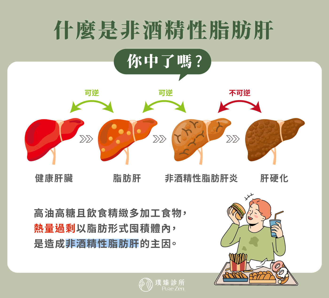 什麼是非酒精性脂肪肝