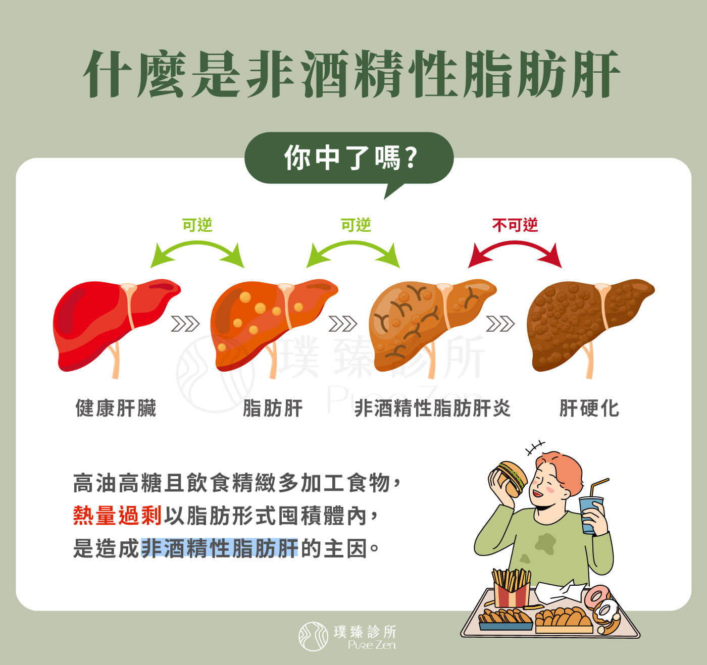 什麼是非酒精性脂肪肝