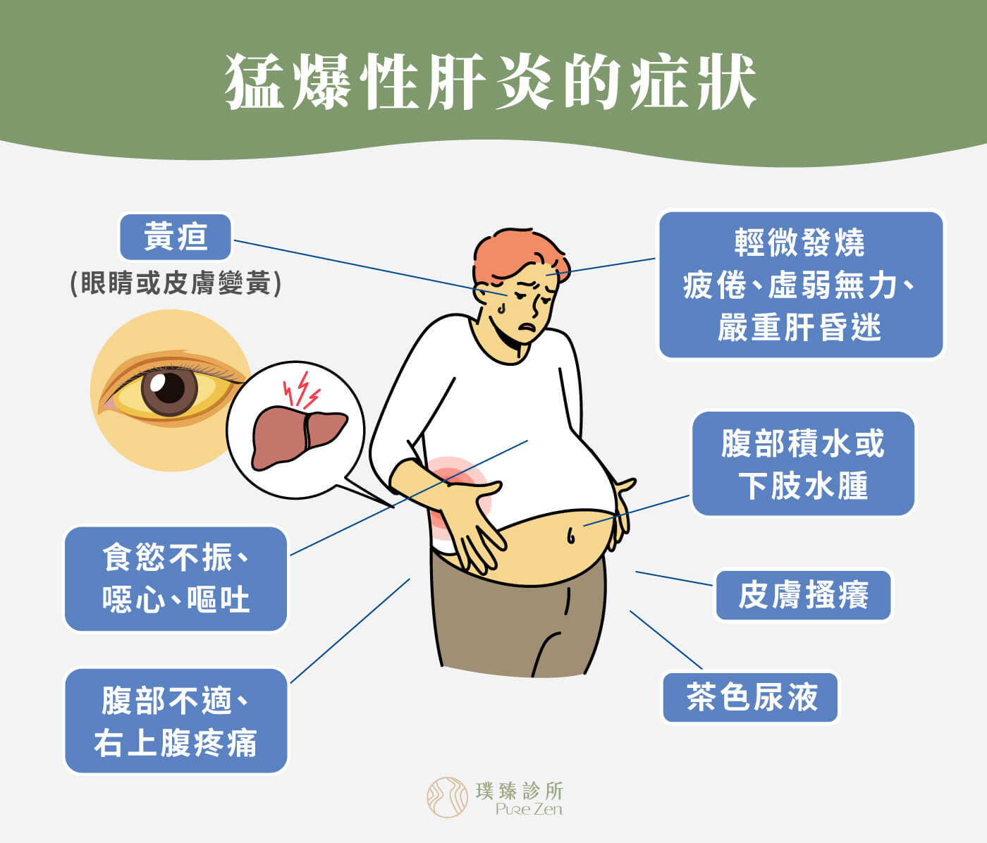 猛爆性肝炎的症狀
