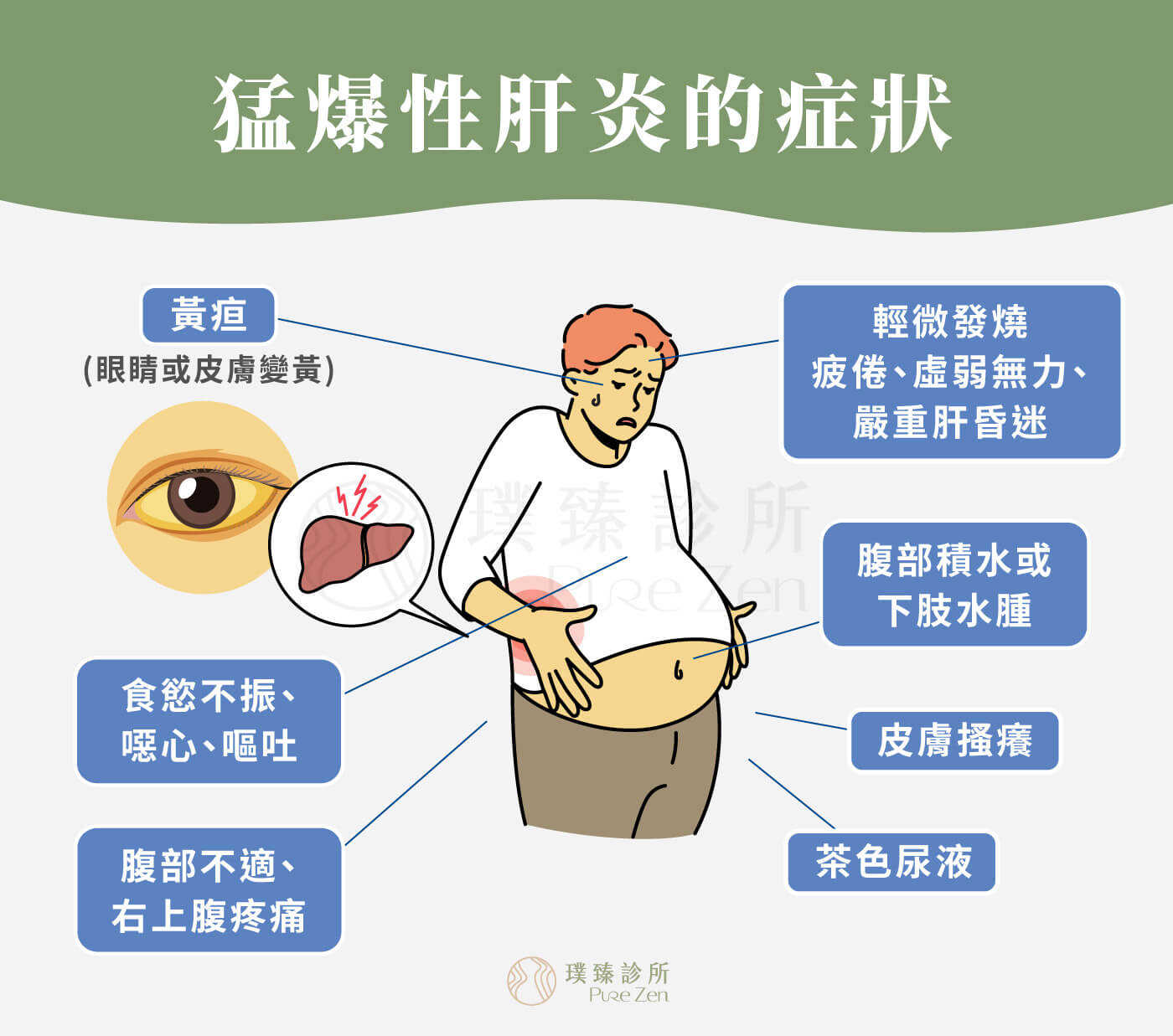 猛爆性肝炎的症狀