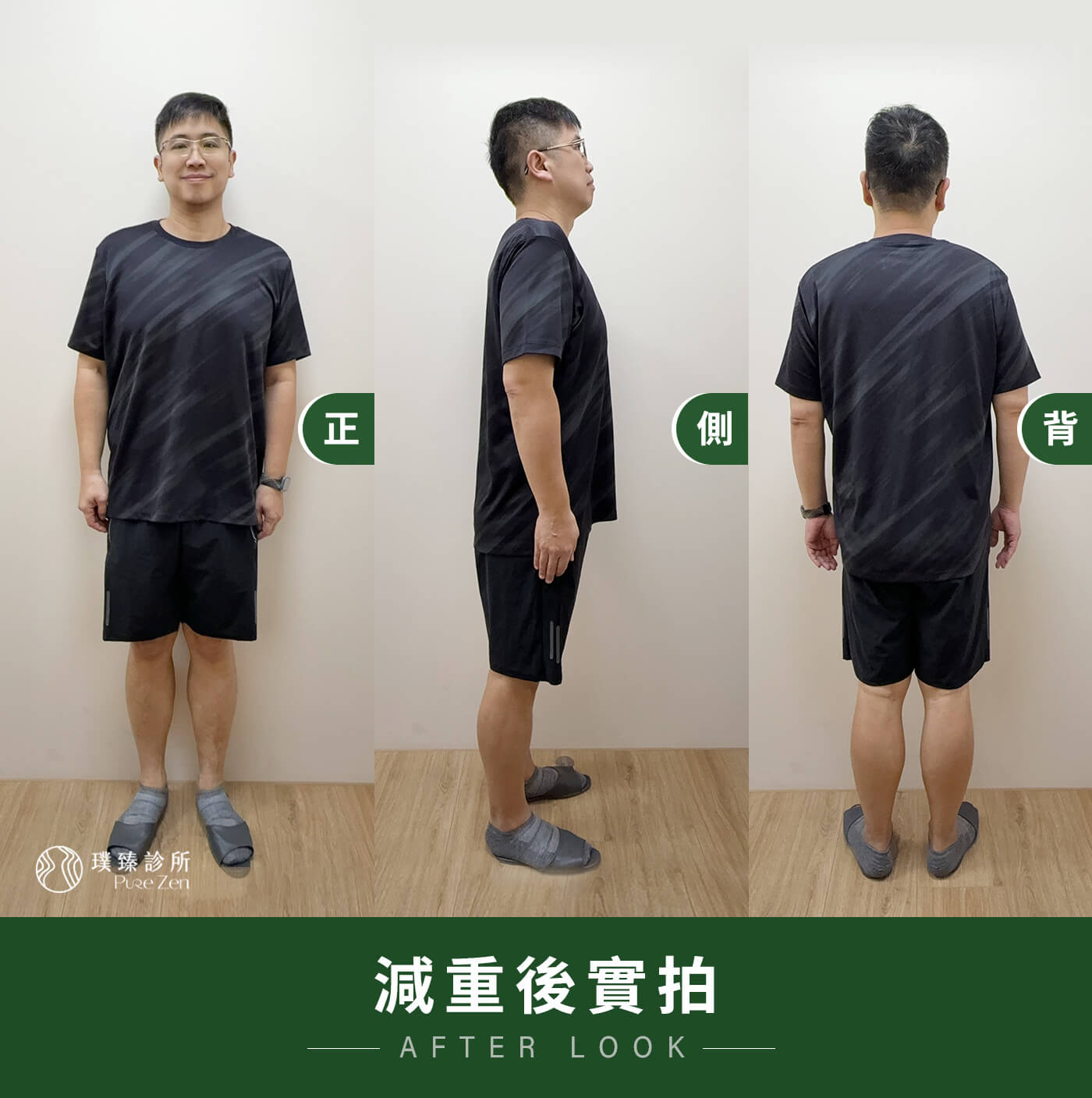 減重案例-壓力型肥胖-三階段減重策略,整個減重過程規劃為三個階段,歷時半年多,讓身體逐步適應改變。初期重點在於穩定代謝與降低內臟脂肪,讓身體不再處於高度發炎與壓力狀態。隨著食慾穩定,暴食衝動明顯下降。中期著重於體脂下降與胰島素阻抗改善,體力與精神狀態逐漸回升,血糖數據也趨於穩定。後期則建立可長期維持的生活與飲食模式,不再依賴意志力硬撐,而是身體自然不想亂吃、不容易復胖。 減重案例-壓力型肥胖-三階段減重策略