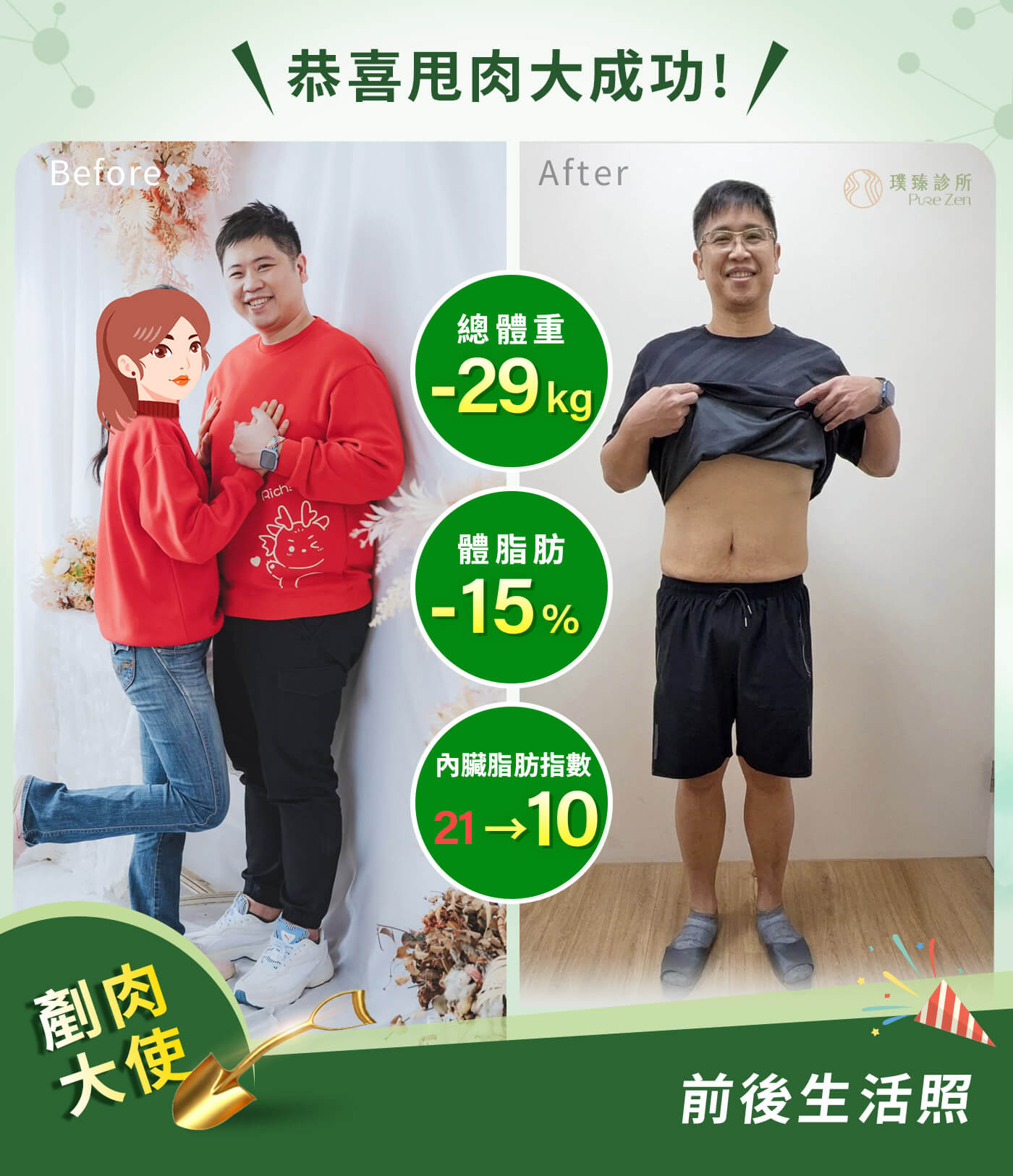 減重案例-壓力型肥胖-減重成果擺脫內臟脂肪,在這個減重案例中,熊先生最感動的並不是體重數字下降,而是一個原本以為錯過的家庭回憶。這次減重帶來的,不只是體型改變,而是重新擁有與家人一起創造回憶的能力。在臨床經驗中,當體重與內臟脂肪逐步下降、代謝狀態改善後,患者最明顯的感受,往往不是數字,而是生活中「做得到的事情變多了」——體力提升、行動更輕鬆,也更願意參與家庭活動。 減重案例-壓力型肥胖-體重與內臟脂肪逐步下降代謝狀態改善