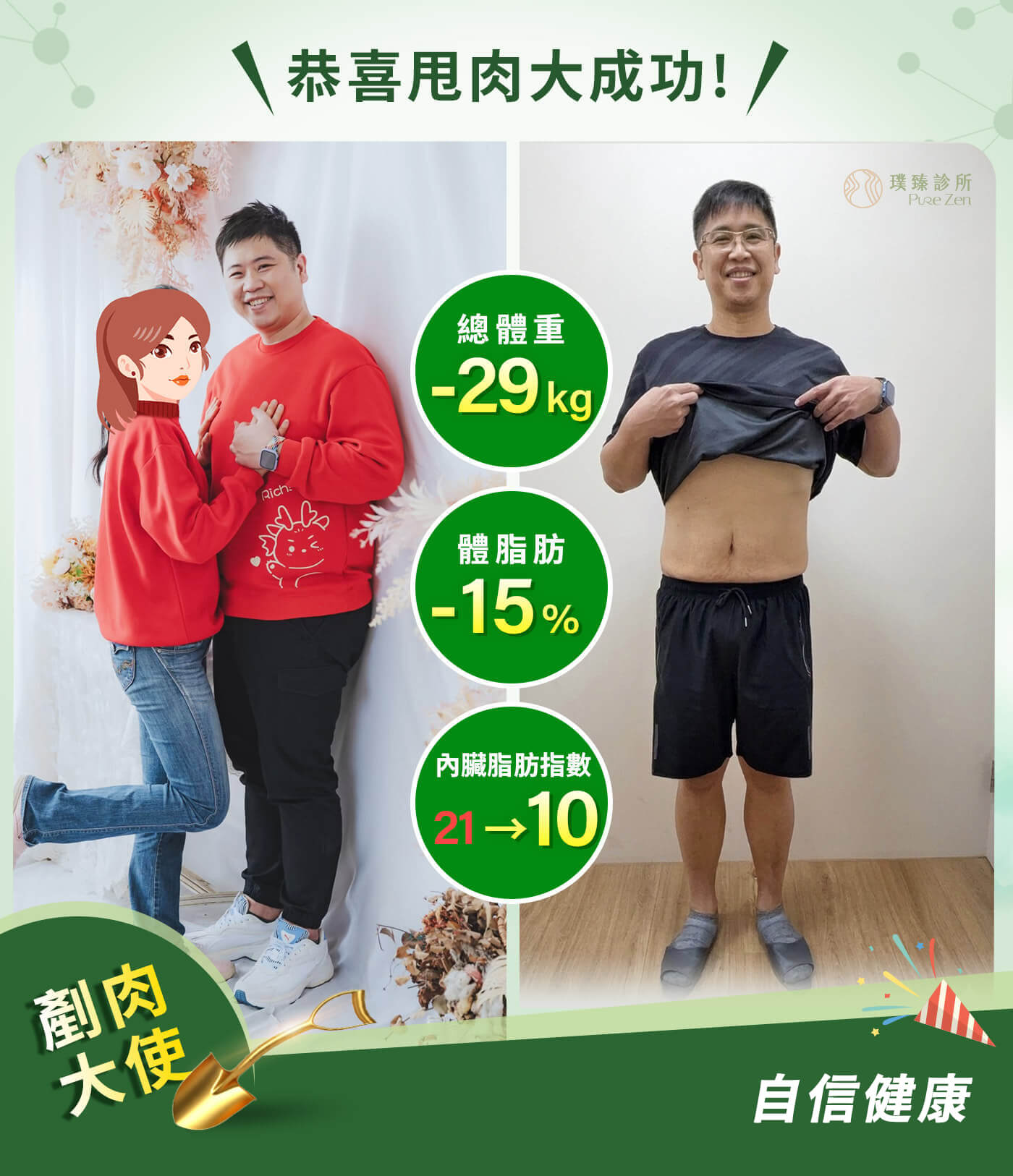 減重案例-壓力型肥胖-減重成果擺脫內臟脂肪,在這個減重案例中,熊先生最感動的並不是體重數字下降,而是一個原本以為錯過的家庭回憶。這次減重帶來的,不只是體型改變,而是重新擁有與家人一起創造回憶的能力。在臨床經驗中,當體重與內臟脂肪逐步下降、代謝狀態改善後,患者最明顯的感受,往往不是數字,而是生活中「做得到的事情變多了」——體力提升、行動更輕鬆,也更願意參與家庭活動。 06-減重後BA-2_0 (1)