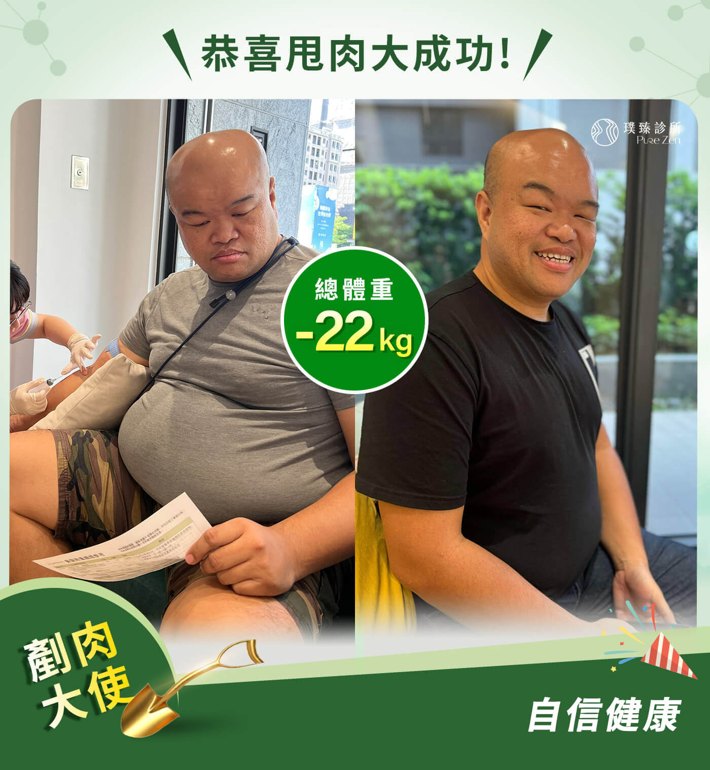 06-減重後BA_0 (1)