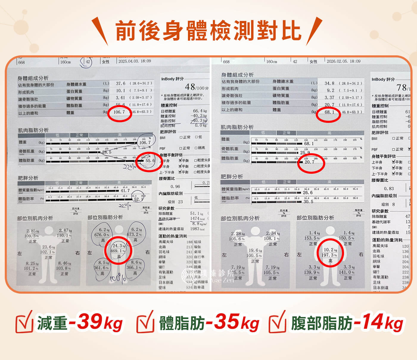 減重案例-壓力型肥胖-減重成果擺脫內臟脂肪,經過半年多的減重門診療程後,熊先生的身體出現明顯改變。體重從 119 公斤下降至 90 公斤,總共減下 29 公斤;體脂肪下降約 15%;內臟脂肪指數從破表的 21,改善至 10。更重要的是,血糖與胰島素相關指標明顯改善,身體發炎狀況降低,精神與體力大幅提升。 inbody_糖尿病減重案例_10 個月減重 39公斤_KO九年糖尿病逆轉糖化血色素