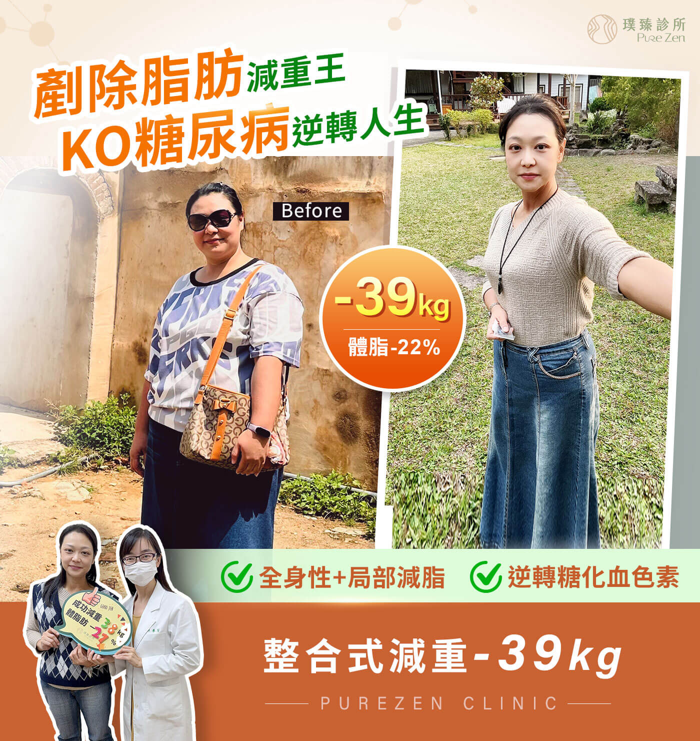 糖尿病減重案例- 10 個月減重 39公斤，KO九年糖尿病逆轉糖化血色素