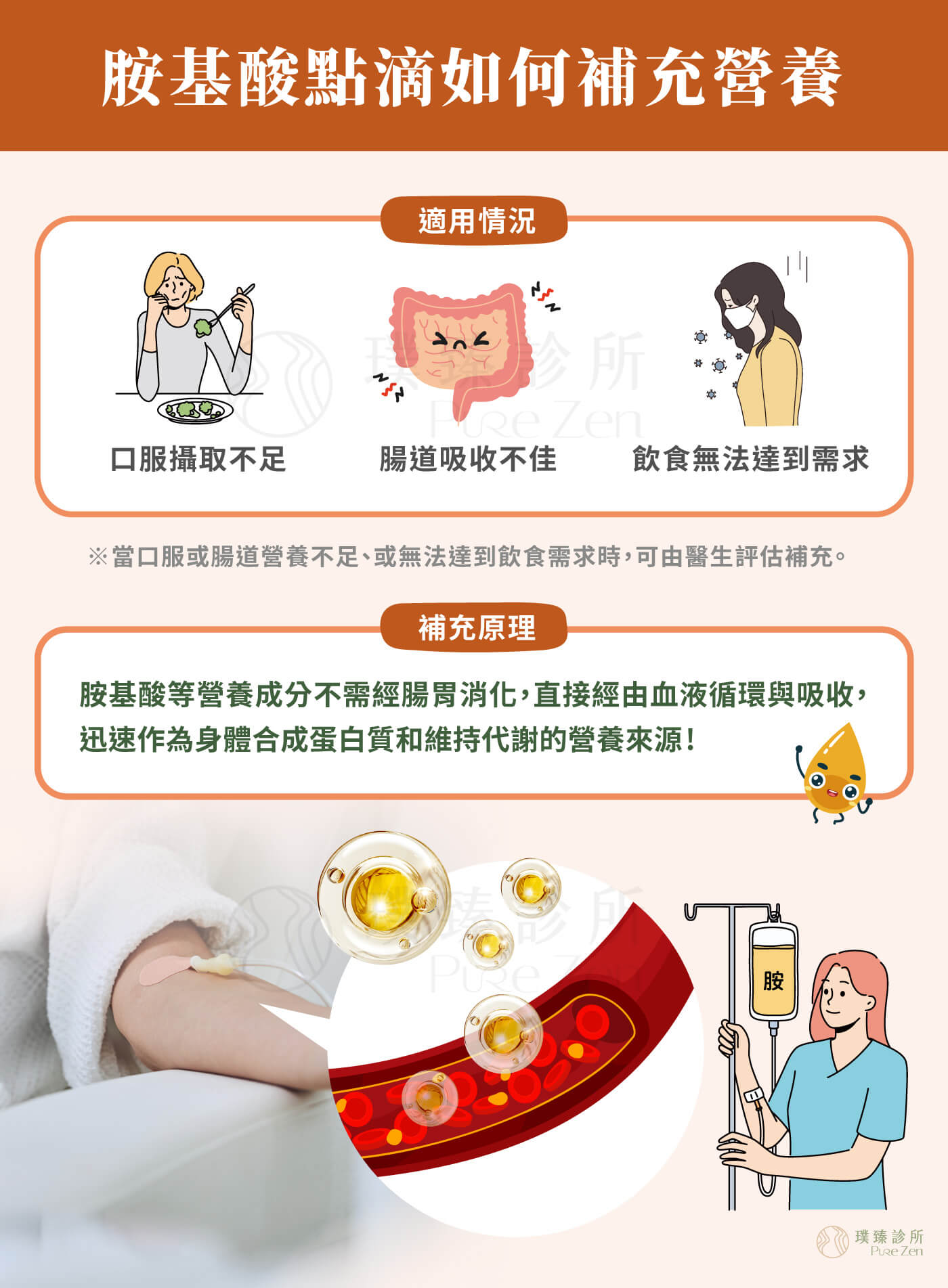 胺基酸點滴的補充原理,靜脈胺基酸點滴常作為腸外營養的補充選擇,不經腸胃道消化吸收,直接進入血液循環。用於口服或腸道營養不足、不適合或飲食無法達到需求時,胺基酸點滴作為身體合成蛋白質與維持代謝功能的營養來源。亦可依照個案身體狀況,搭配維生素B群、維他命C、礦物質或其他營養配方,作為客製化功能醫學點滴的一環。 胺基酸點滴的補充原理