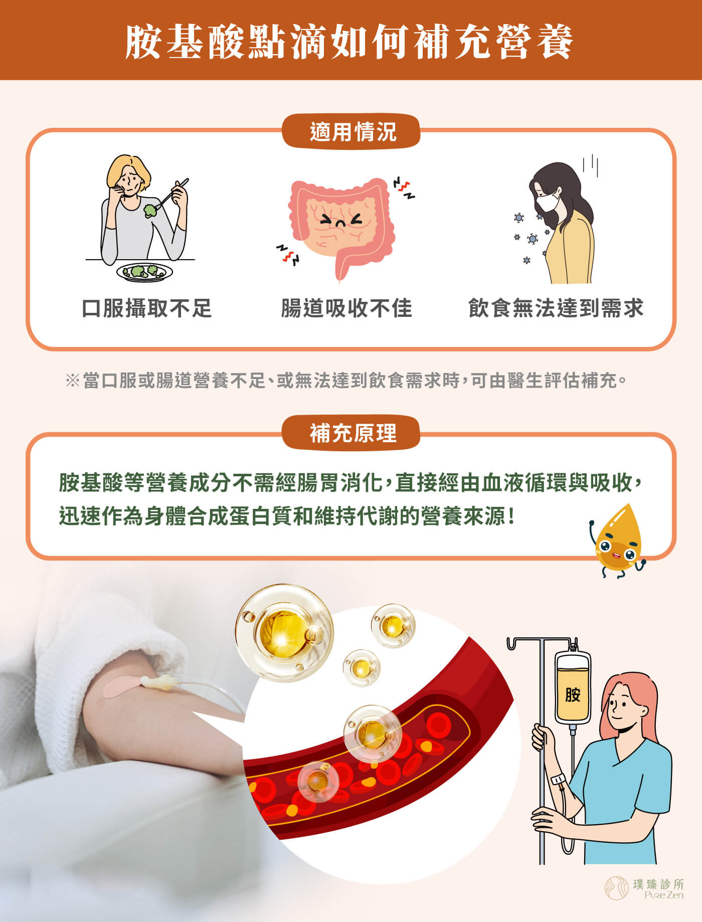 胺基酸點滴的補充原理,靜脈胺基酸點滴常作為腸外營養的補充選擇,不經腸胃道消化吸收,直接進入血液循環。用於口服或腸道營養不足、不適合或飲食無法達到需求時,胺基酸點滴作為身體合成蛋白質與維持代謝功能的營養來源。亦可依照個案身體狀況,搭配維生素B群、維他命C、礦物質或其他營養配方,作為客製化功能醫學點滴的一環。 胺基酸點滴的補充原理