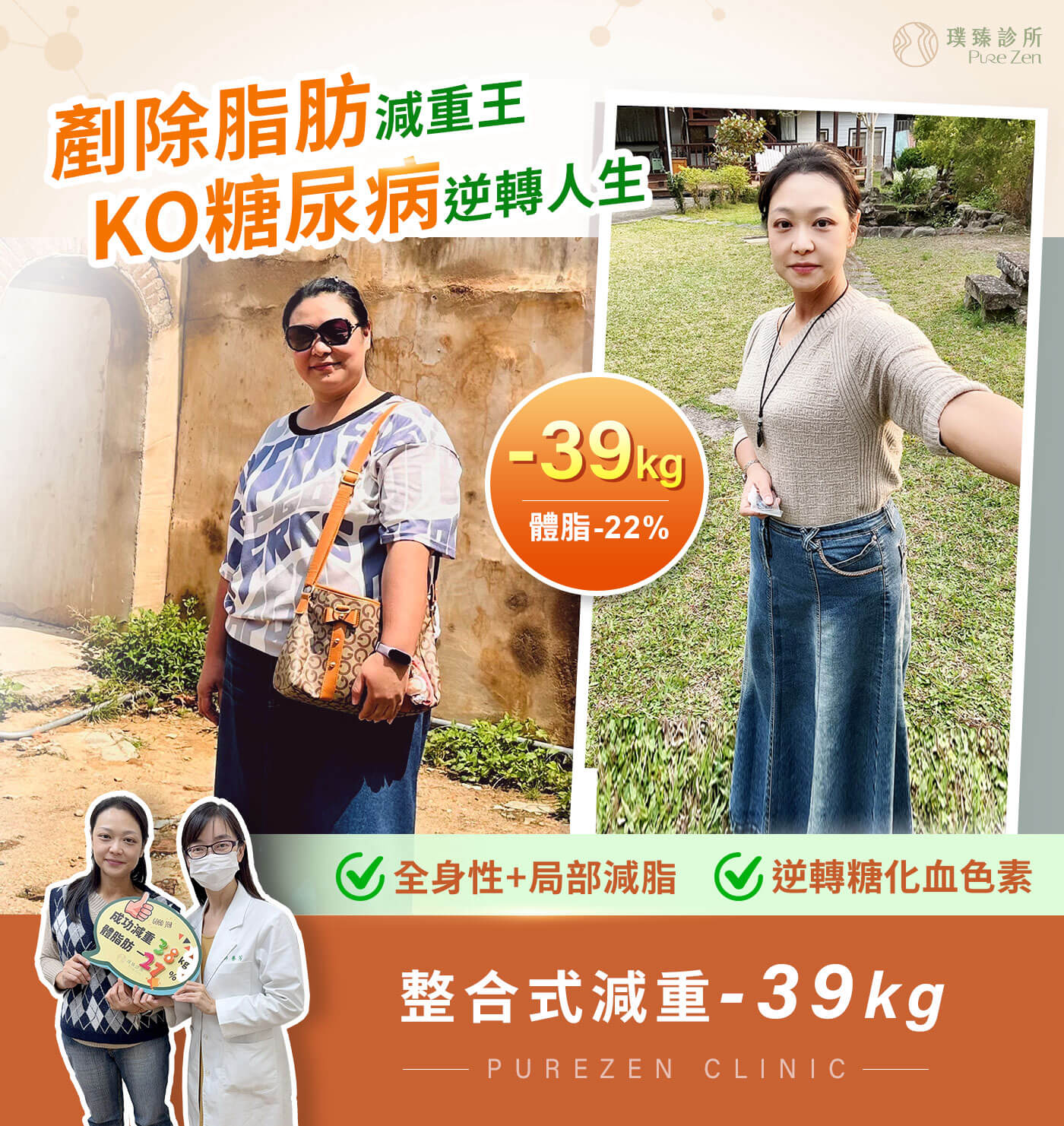 糖尿病減重案例- 10 個月減重 39公斤,KO九年糖尿病逆轉糖化血色素 糖尿病減重案例- 10 個月減重 39公斤,KO九年糖尿病逆轉糖化血色素
