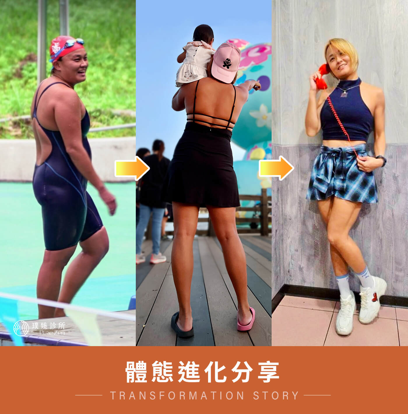 產後肥胖減重案例-營養補給支持運動後恢復,蔡學毅醫師依照小柔老師的身體狀況規劃客製化營養點滴補給, 營養補給的目的不是取代飲食,也不是讓體重短時間快速下降,而是幫助身體在減重過程中有更好的支持。 產後肥胖減重案例-營養補給支持運動後恢復