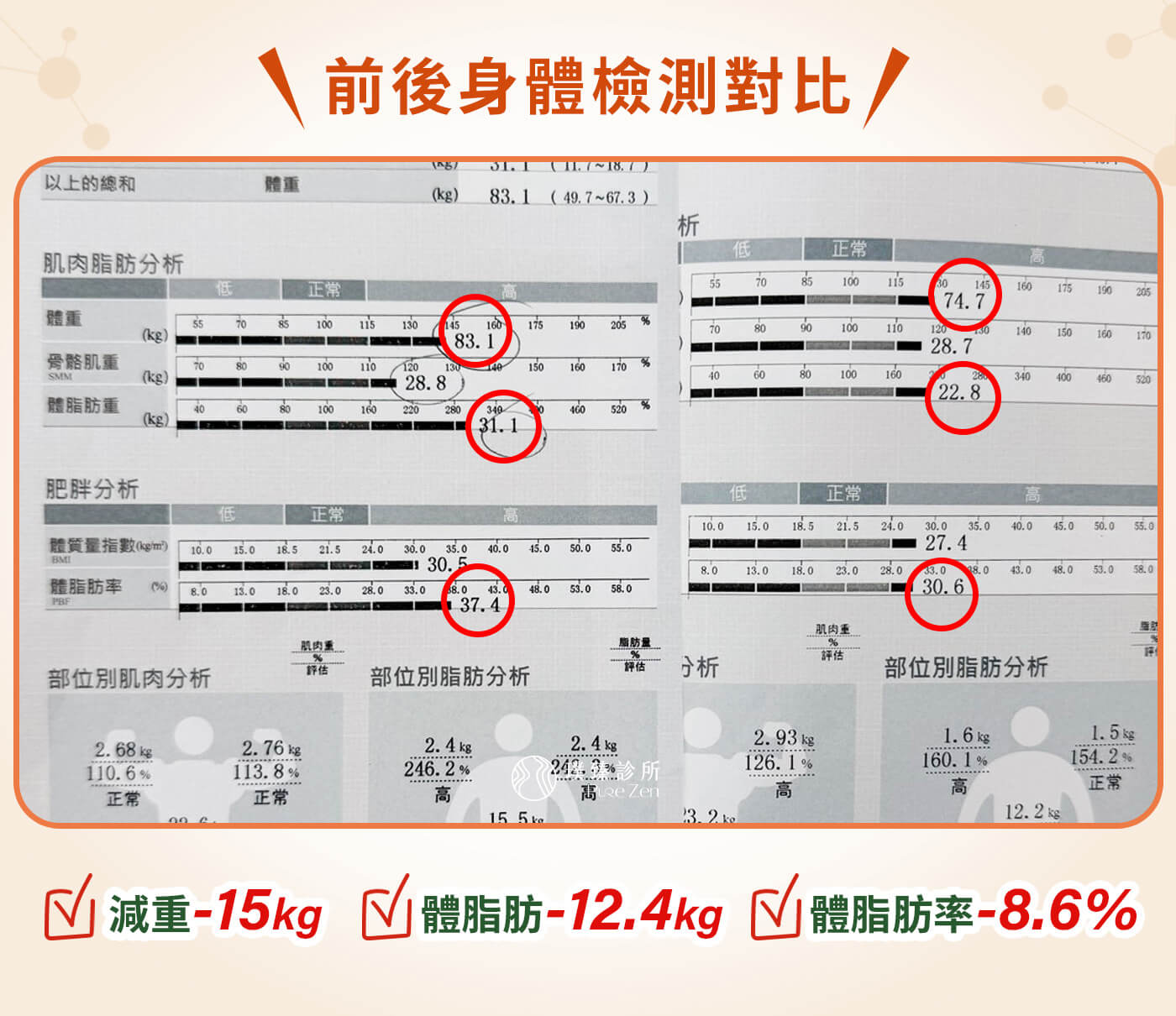 產後肥胖減重案例-產後肥胖減重策略,小柔老師在飲食調整後,甚至覺得自己吃得比原本更多,但體重反而開始下降。當身體有足夠營養、睡眠改善、恢復變好,減重可以變得更穩定,也更適合長期維持。 減重卡關案例前後體測對比inbody