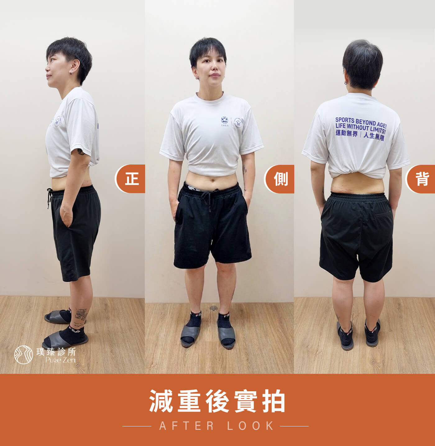 減重卡關案例減重後正側背身形變化 減重卡關案例減重後正側背身形變化
